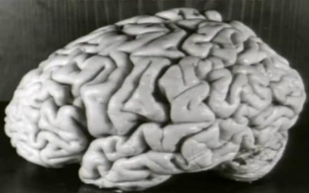 Albert Einstein – O Cérebro Preservado do Físico Teórico