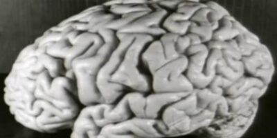 O cérebro de Albert Einstein, um dos maiores gênios da ciência, foi removido sem o conhecimento e consentimento da família após sua morte em 1955.