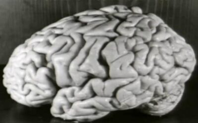 Albert Einstein – O Cérebro Preservado do Físico Teórico