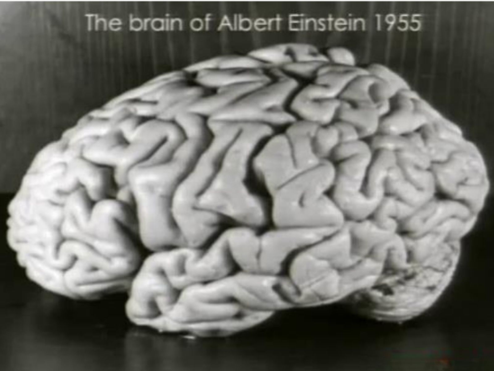 Albert Einstein – O Cérebro Preservado do Físico Teórico