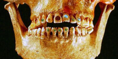 A descoberta de uma caveira adornada com pedras preciosas nos dentes em Chiapas, México, foi uma das mais fascinantes realizações arqueológicas dos últimos anos. Encontrada pelo Instituto Nacional de Antropologia e História (INAH), a Caveira de Jade possui pedras preciosas incrustadas nos dentes, sendo a jade uma das pedras mais valorizadas e importantes para as culturas mesoamericanas.