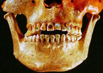 A descoberta de uma caveira adornada com pedras preciosas nos dentes em Chiapas, México, foi uma das mais fascinantes realizações arqueológicas dos últimos anos. Encontrada pelo Instituto Nacional de Antropologia e História (INAH), a Caveira de Jade possui pedras preciosas incrustadas nos dentes, sendo a jade uma das pedras mais valorizadas e importantes para as culturas mesoamericanas.