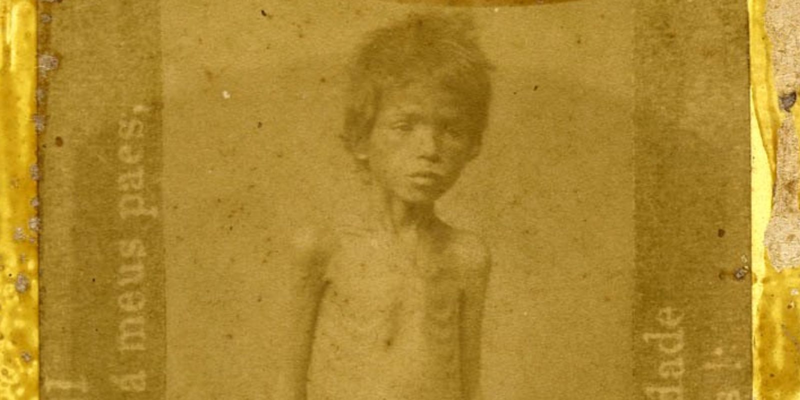 Uma criança, visivelmente debilitada pela fome e pela sede, representa o sofrimento humano causado pela Grande Seca do Nordeste. Milhares de crianças foram as maiores vítimas dessa tragédia, sucumbindo a doenças e à desnutrição.