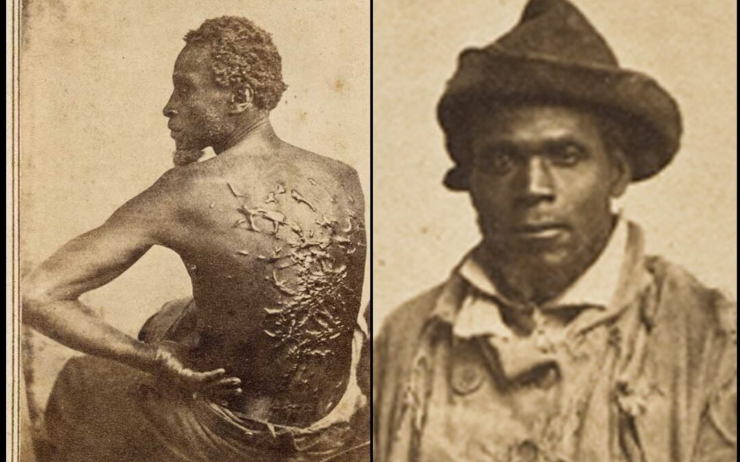 Gordon “Whipped Peter”: A História de um Herói da Abolição