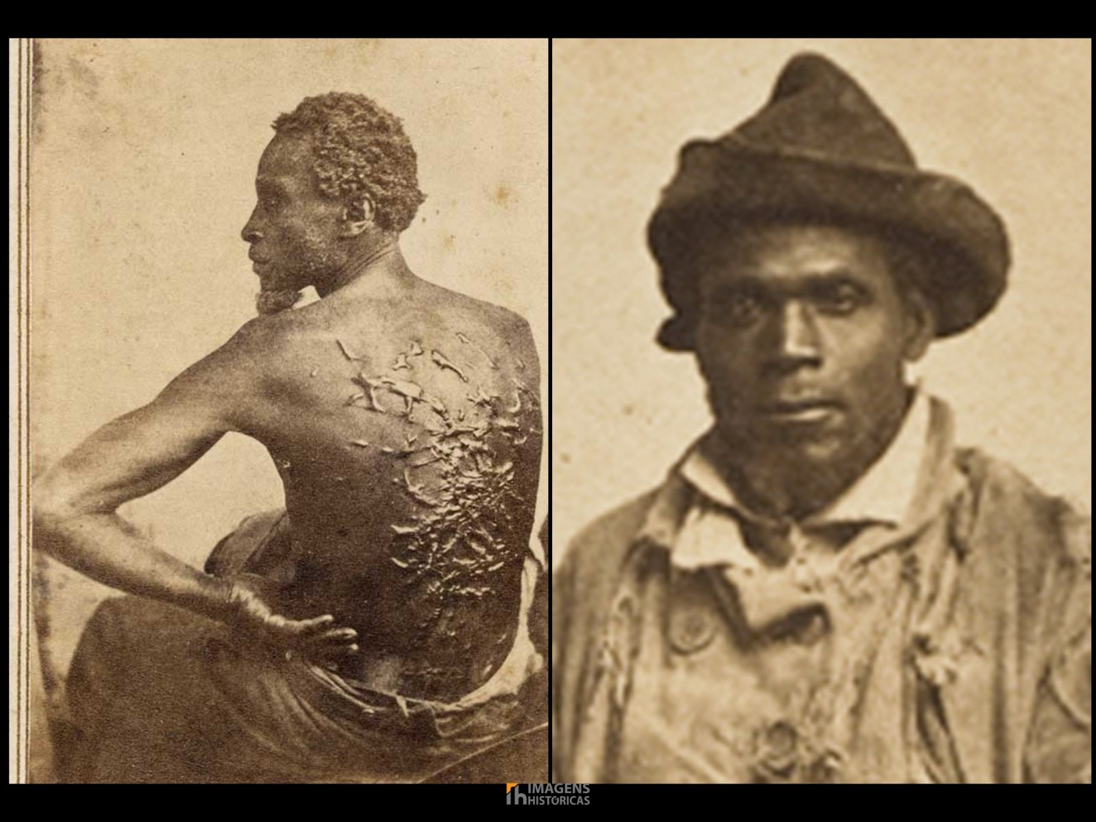 Gordon “Whipped Peter”: A História de um Herói da Abolição