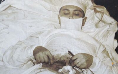 Leonid Rogozov: O Médico que Operou a Si Mesmo na Antártica
