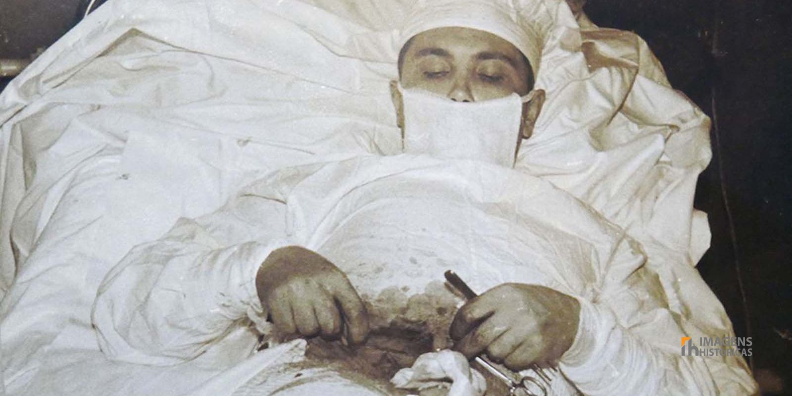 Leonid Rogozov se recuperando duas semanas após a autocirurgia. Sua rápida recuperação é um testemunho de sua habilidade cirúrgica e de sua incrível força de vontade. Leonid Rogozov se recuperando duas semanas após a autocirurgia. Sua rápida recuperação é um testemunho de sua habilidade cirúrgica e de sua incrível força de vontade.