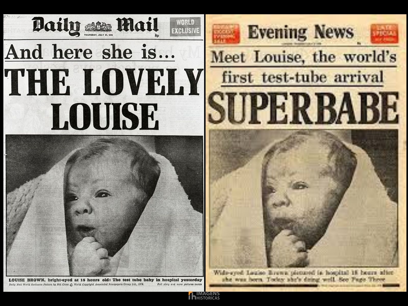 Louise Joy Brown nasceu no dia 25 de julho de 1978, em Oldham, Inglaterra, e ficou mundialmente conhecida como a primeira pessoa concebida através da fertilização in vitro (FIV). O nascimento de Louise Brown marcou um divisor de águas na medicina reprodutiva, trazendo esperanças para milhões de casais que enfrentavam dificuldades para conceber filhos. Louise Joy Brown nasceu no dia 25 de julho de 1978, em Oldham, Inglaterra, e ficou mundialmente conhecida como a primeira pessoa concebida através da fertilização in vitro (FIV). O nascimento de Louise Brown marcou um divisor de águas na medicina reprodutiva, trazendo esperanças para milhões de casais que enfrentavam dificuldades para conceber filhos.
