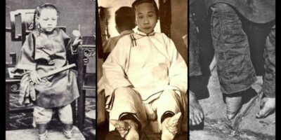Os pés de lótus, foi uma prática tradicional na China por cerca de mil anos. Começou durante a Dinastia Song (960-1279) e perdurou até o início do século XX. Esta prática foi principalmente um símbolo de beleza e status social para as mulheres, mas também causou deformações permanentes e muito sofrimento.