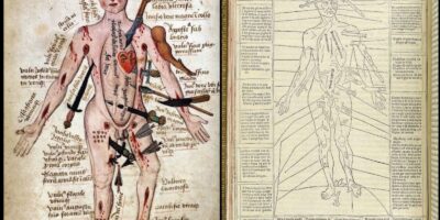 “Wound Man” (homem ferido, em português), é uma ilustração notável que apareceu pela primeira vez no livro Fasciculus Medicinae, publicado em Veneza em 1492. O compêndio médico da Renascença é conhecido por integrar imagens detalhadas e textos médicos para facilitar a prática clínica. A figura do Wound Man simboliza o avanço na educação médica e reflete o esforço da época em entender melhor as condições de saúde e os métodos de tratamento.